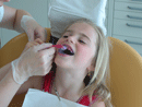 Kinderzahnheilkunden beim Zahnarzt in Gemünden